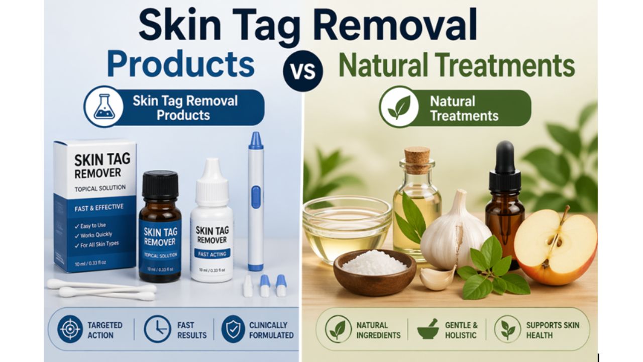 Top Skin Tag Removal Products vs Natural Treatments A Comprehensive Guide