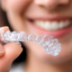 Why Aligner Sheets Matter in Clear Aligner Treatment 