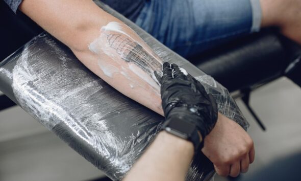 How Long Full Tattoo Removal Really Takes