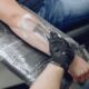 How Long Full Tattoo Removal Really Takes