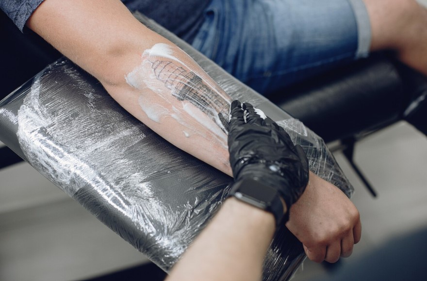 How Long Full Tattoo Removal Really Takes