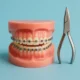 Modern Orthodontic Solutions for a Confident Smile