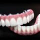Comparing Dentures and Fixed Full-Arch Tooth Replacement