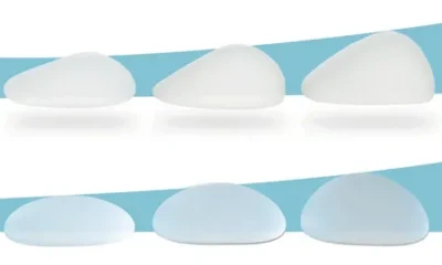 Lift, Implant or Both