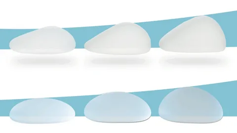 Lift, Implant or Both